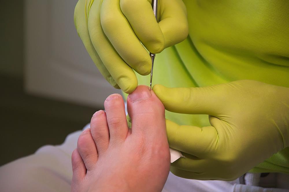 south florida podiatry podiatrist in lake worth florida